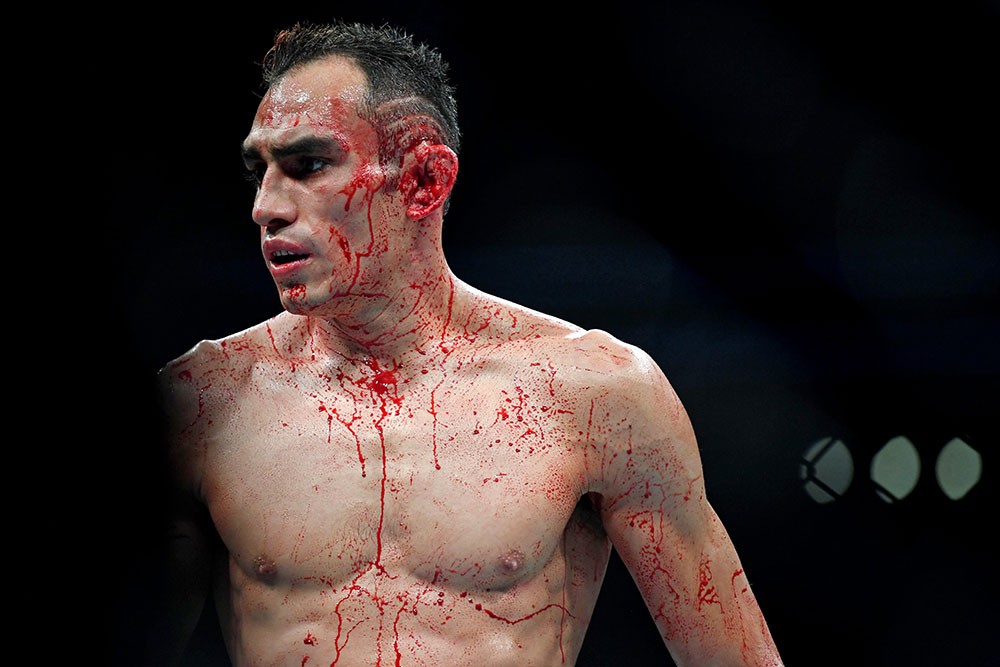 Anthony Pettis gãy xương bàn tay trong cuộc đối đầu với Tony Ferguson - Ảnh 8. Anthony Pettis gãy xương bàn tay trong cuộc đối đầu với Tony Ferguson - Ảnh 8.