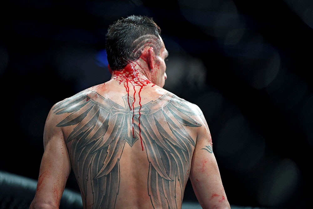 Anthony Pettis gãy xương bàn tay trong cuộc đối đầu với Tony Ferguson - Ảnh 7. Anthony Pettis gãy xương bàn tay trong cuộc đối đầu với Tony Ferguson - Ảnh 7.