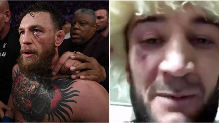 Em họ Khabib nói gì sau khi rời đồn cảnh sát vì vụ ẩu đả với Conor McGregor?