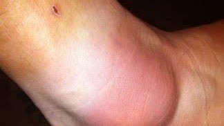 Độc đáo món thuốc bí chế của các võ sĩ Muay ở Thái Lan