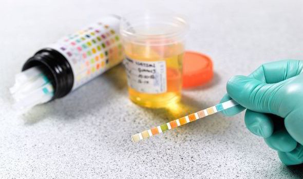 Góc nhìn của kẻ hoài nghi: Vì sao họ nói Jon Jones không dùng doping trong khi Jones không thể sạch? - Ảnh 1. Góc nhìn của kẻ hoài nghi: Vì sao họ nói Jon Jones không dùng doping trong khi Jones không thể sạch? - Ảnh 1.