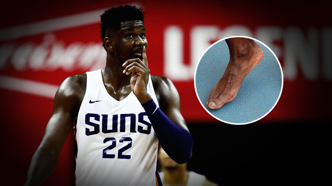 Sai lầm chí mạng ngăn cản Puma vượt mặt Nike tại NBA chính là... bàn chân của siêu tân binh