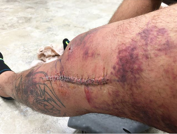 Tony Ferguson đã hồi phục, sẵn sàng trở lại cuộc đua tranh đai Lightweight UFC - Ảnh 3. Tony Ferguson đã hồi phục, sẵn sàng trở lại cuộc đua tranh đai Lightweight UFC - Ảnh 3.