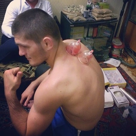 Giác hơi đã giúp Conor McGregor chuẩn bị cho trận siêu đấu với Khabib như thế nào? - Ảnh 7. Giác hơi đã giúp Conor McGregor chuẩn bị cho trận siêu đấu với Khabib như thế nào? - Ảnh 7.