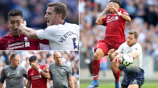 Bị "móc mắt" đau đớn, Firmino có kịp hồi phục đá với PSG tại Champions League?