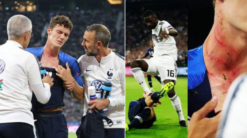 Ngôi sao vô địch World Cup của tuyển Pháp bị giẫm lên cổ trận gặp Đức tại UEFA Nations League