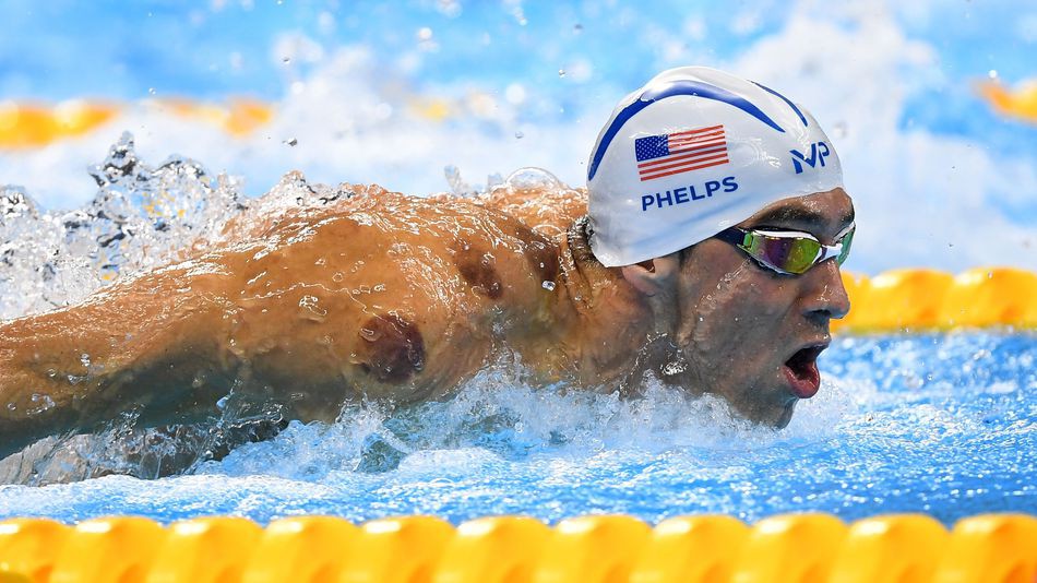 Những vết đỏ trên người Michael Phelps là ''dấu tích'' từ những lần giác hơi Những vết đỏ trên người Michael Phelps là ''dấu tích'' từ những lần giác hơi