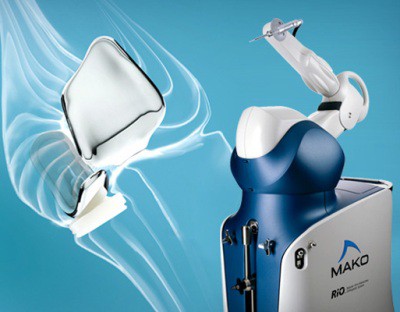 Phương pháp tái tạo đầu gối MAKOplasty