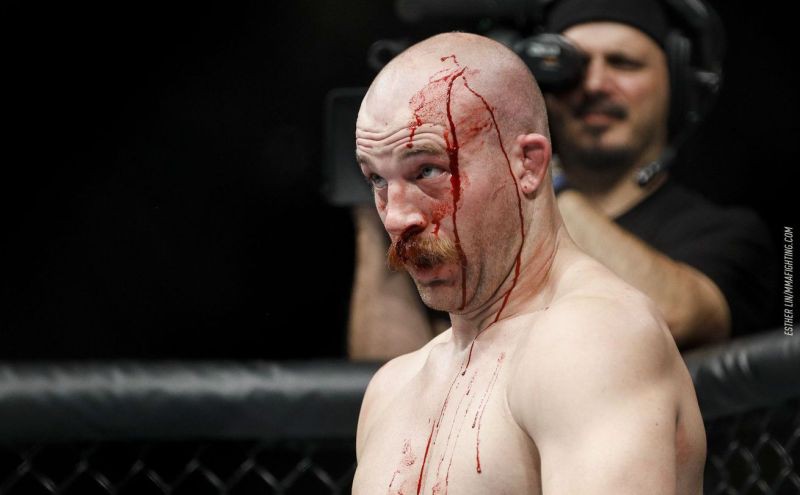 Bản tin MMA 18/10: Patrick Cummins rời UFC 217 do nhiễm trùng