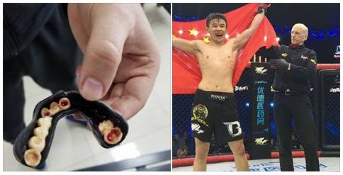 Bản tin MMA 18/12: Võ sĩ Trung Quốc đấu MMA, "bay" mất hàm răng