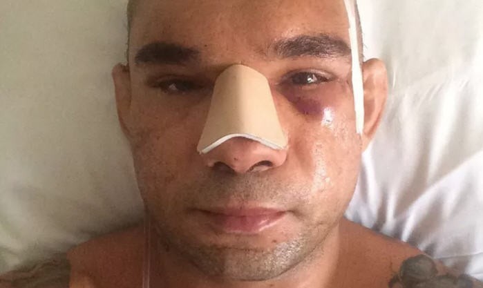 'Cyborg' Santos phẫu thuật thành công