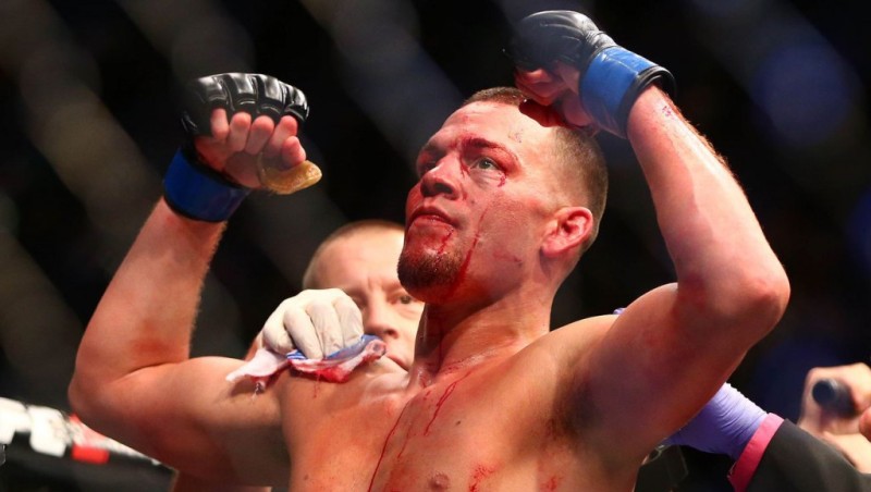 Nate Diaz "định vị" Conor McGregor là đường tắt để kiếm tiền