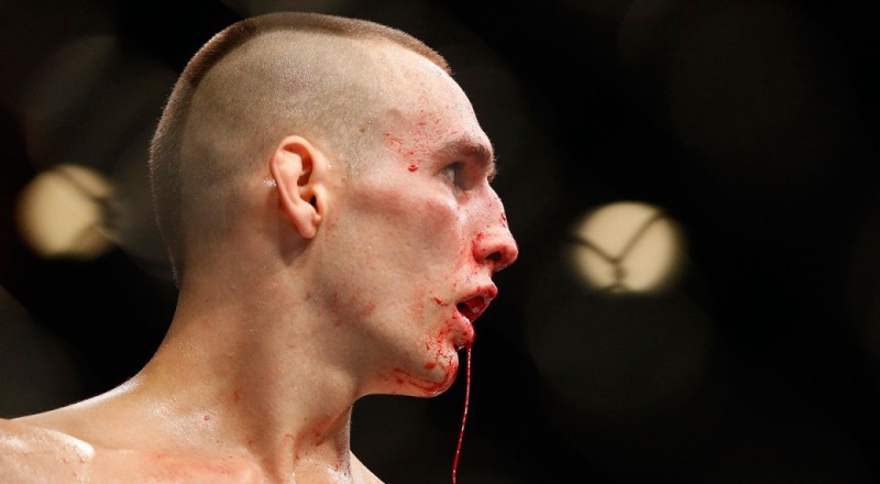 MacDonald có khả năng cần phải phẫu thuật sau UFC Fight Night 89