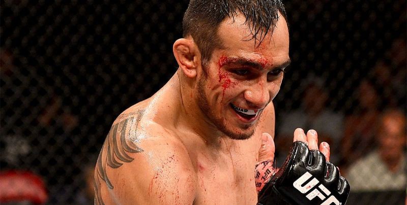 Tony Ferguson: Người ta nghĩ gì kệ họ!