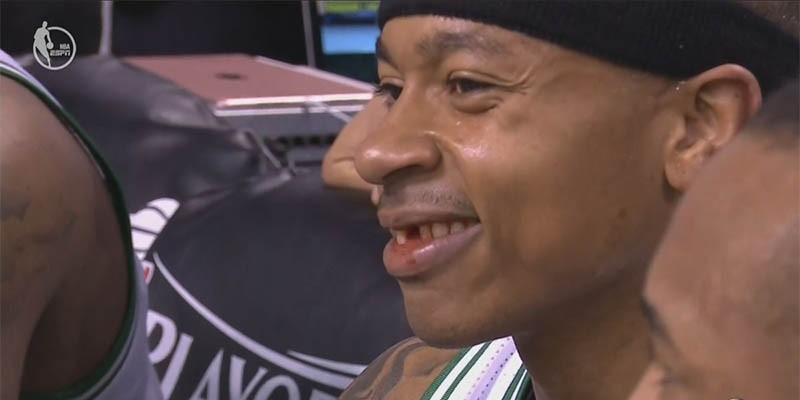 Top 5 vụ… gãy răng nghiêm trọng nhất lịch sử NBA