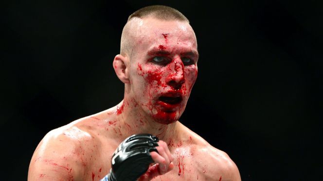 Rory MacDonald sắp "sổ lồng"
