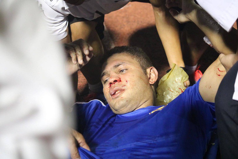 Thiago nghỉ ít nhất 3 tuần, Quảng Nam đau đầu lấp chỗ trống