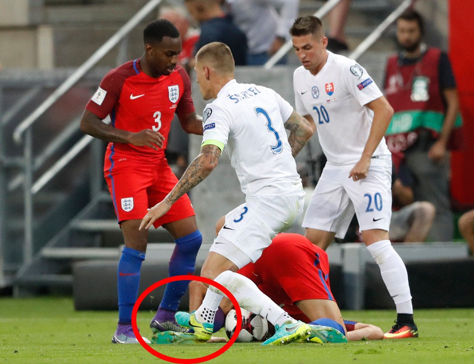 Học Diego Costa, Martin Skrtel dẫm chân Harry Kane