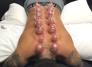 Neymar dùng liệu pháp của... Trung Quốc để hồi phục thể lực