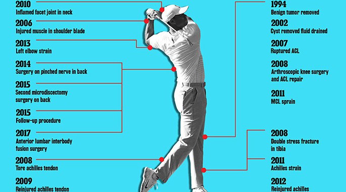 To&agrave;n bộ 17 chấn thương trong sự nghiệp của Tiger Woods.