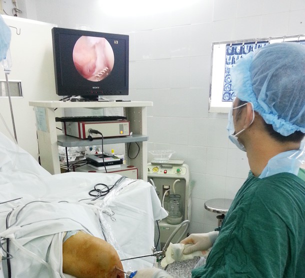 Ảnh minh họa phẫu thuật chấn thương d&acirc;y chằng ch&eacute;o trước. Nguồn: Bệnh viện đa khoa Vạn Hạnh