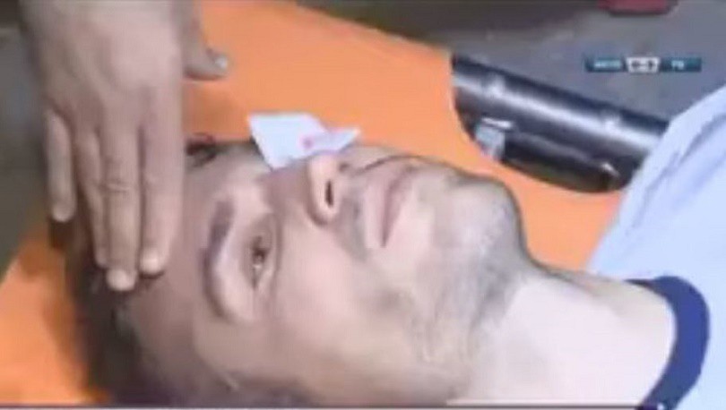 Video: Cận cảnh chấn thương mí mắt kinh hoàng của Van Persie