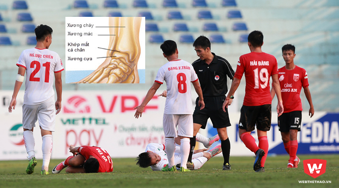 Cựu tuyển thủ U23 đốn gãy xương chày tuyển thủ U20 Việt Nam