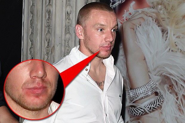 Tiền vệ Jamie O’Hara lại phản bội vợ: Một đêm, hai mỹ nhân