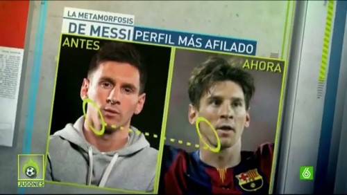 Trước thềm đại chiến, Messi đi phẫu thuật… gọt cằm
